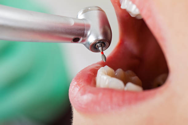 Best Broken or Cracked Tooth Emergency Dentist in Plainview, TN